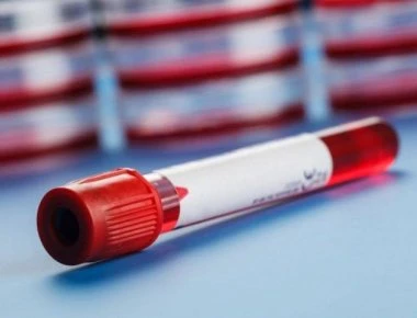 Χαμηλός και υψηλός αιματοκρίτης: Τι σημαίνουν οι τιμές για την υγεία σας